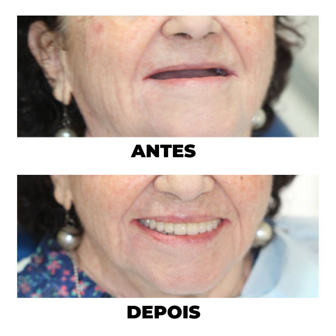Antes e Depois de tratamento odontológico